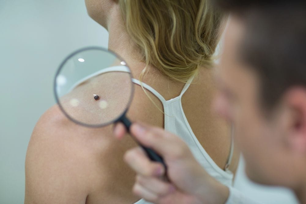 Com escollir el teu dermatòleg a Barcelona